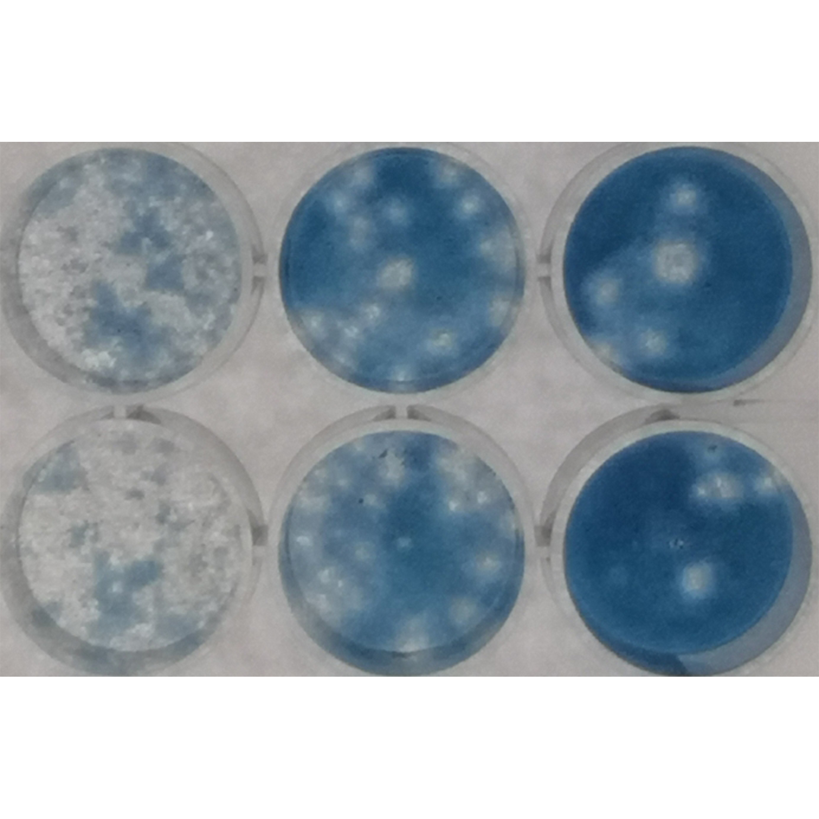 Metoda plakové titrace. Vizualizované plaky (bílá místa bez buněk) po nabarvení zbylých živých neinfikovaných buněk přisedlých na dně jamek titrační desky.